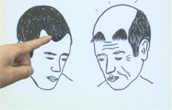 有了人造頭皮,我們還怕禿嗎? 有了人造頭皮,我們還怕禿嗎?