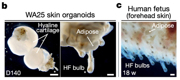 有了人造頭皮,我們還怕禿嗎? 有了人造頭皮,我們還怕禿嗎?