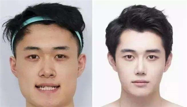 ϻX(qin)(li)͛](mi)Ůʲô